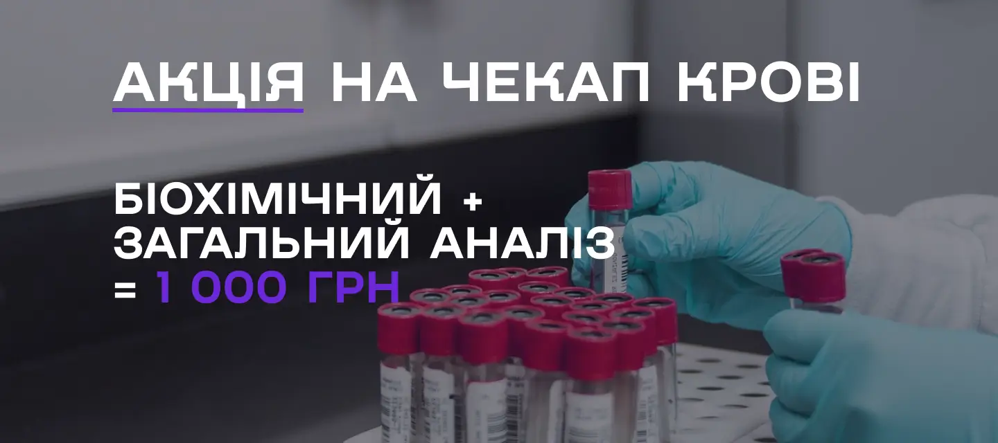 Чекап і аналіз крові у клініці Ковальчук Черкаси
